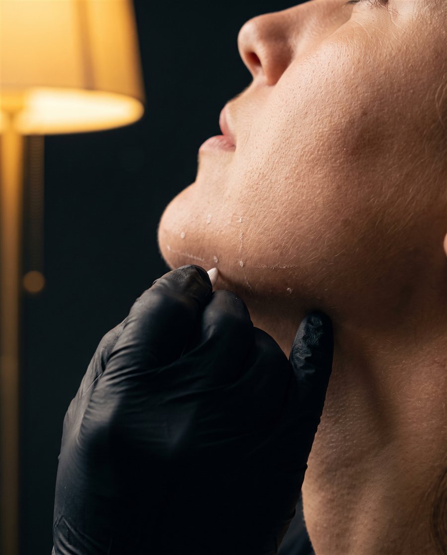 Feminización facial en Orbe Clinics