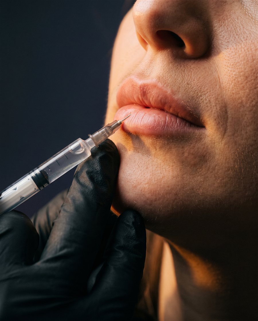 Aumento de labios