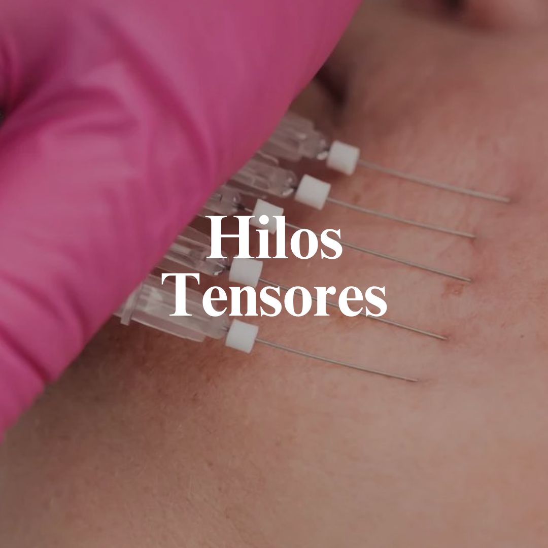 Hilos Tensores