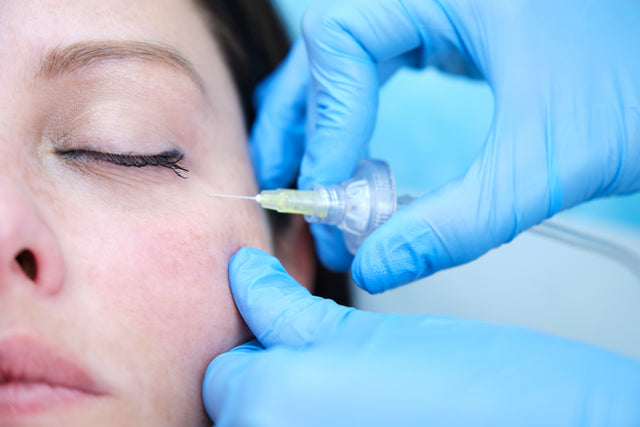 Aplicación médica de carboxiterapia con CO₂ para mejorar la circulación, oxigenar los tejidos y reafirmar la piel en Orbe Clinics.