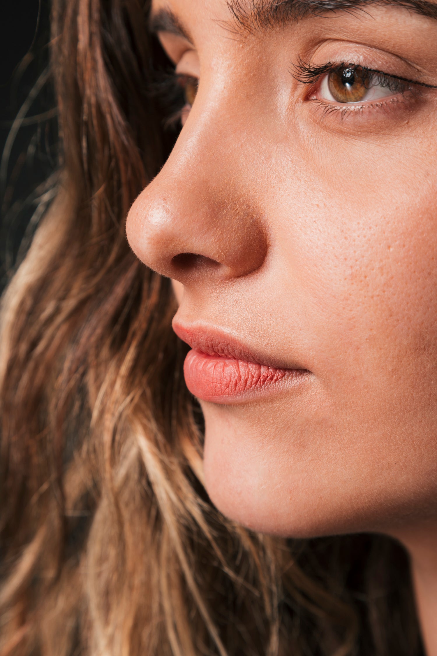 Rostro femenino con perfil armonioso tras rinomodelación con ácido hialurónico en Orbe Clinics.