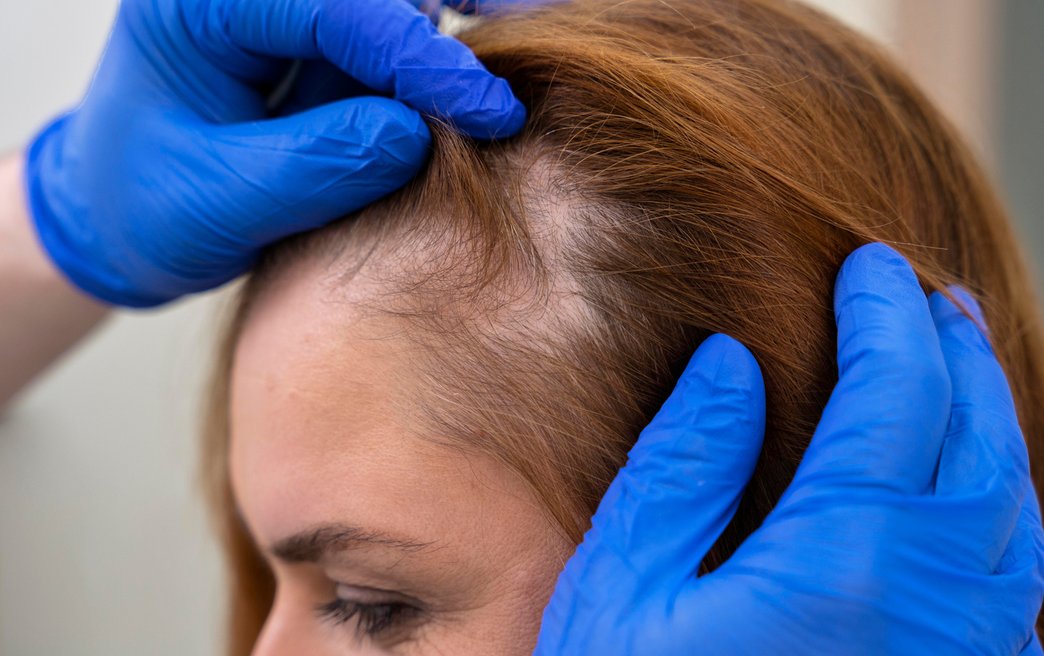 Consulta de tricología médica en Orbe Clinics con dermatoscopia digital y diagnóstico capilar especializado.