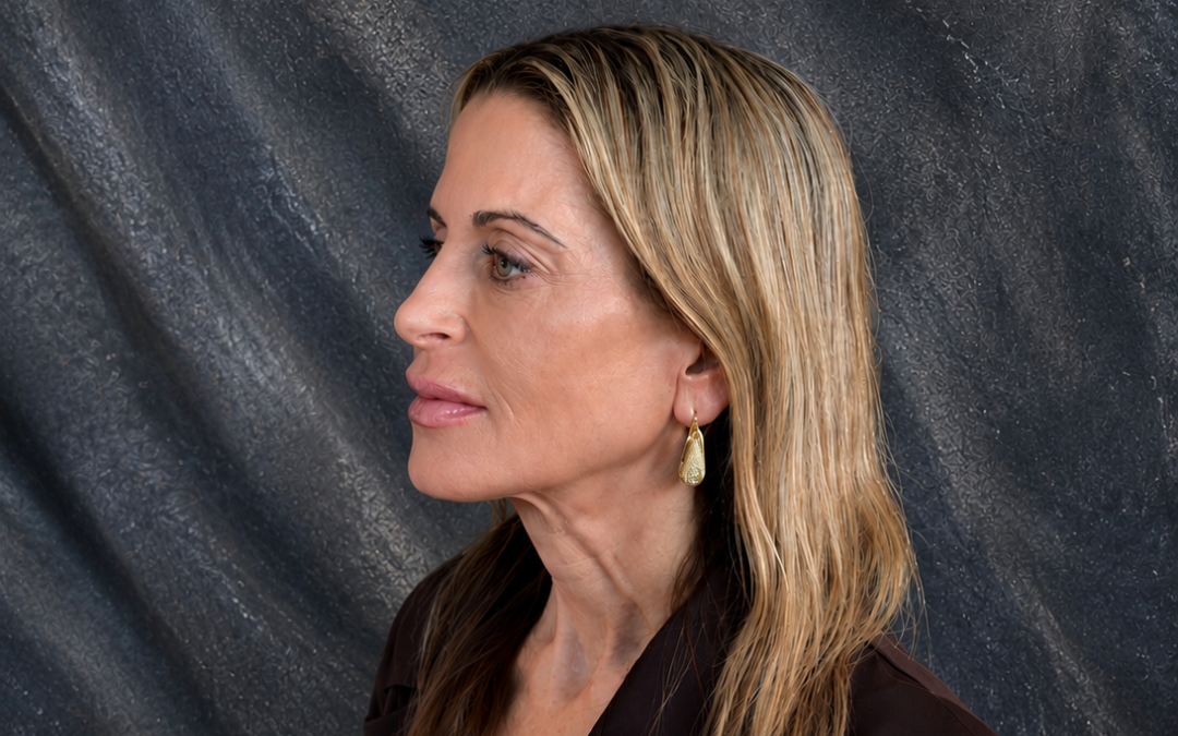 Después del rejuvenecimiento facial en Orbe Clinics