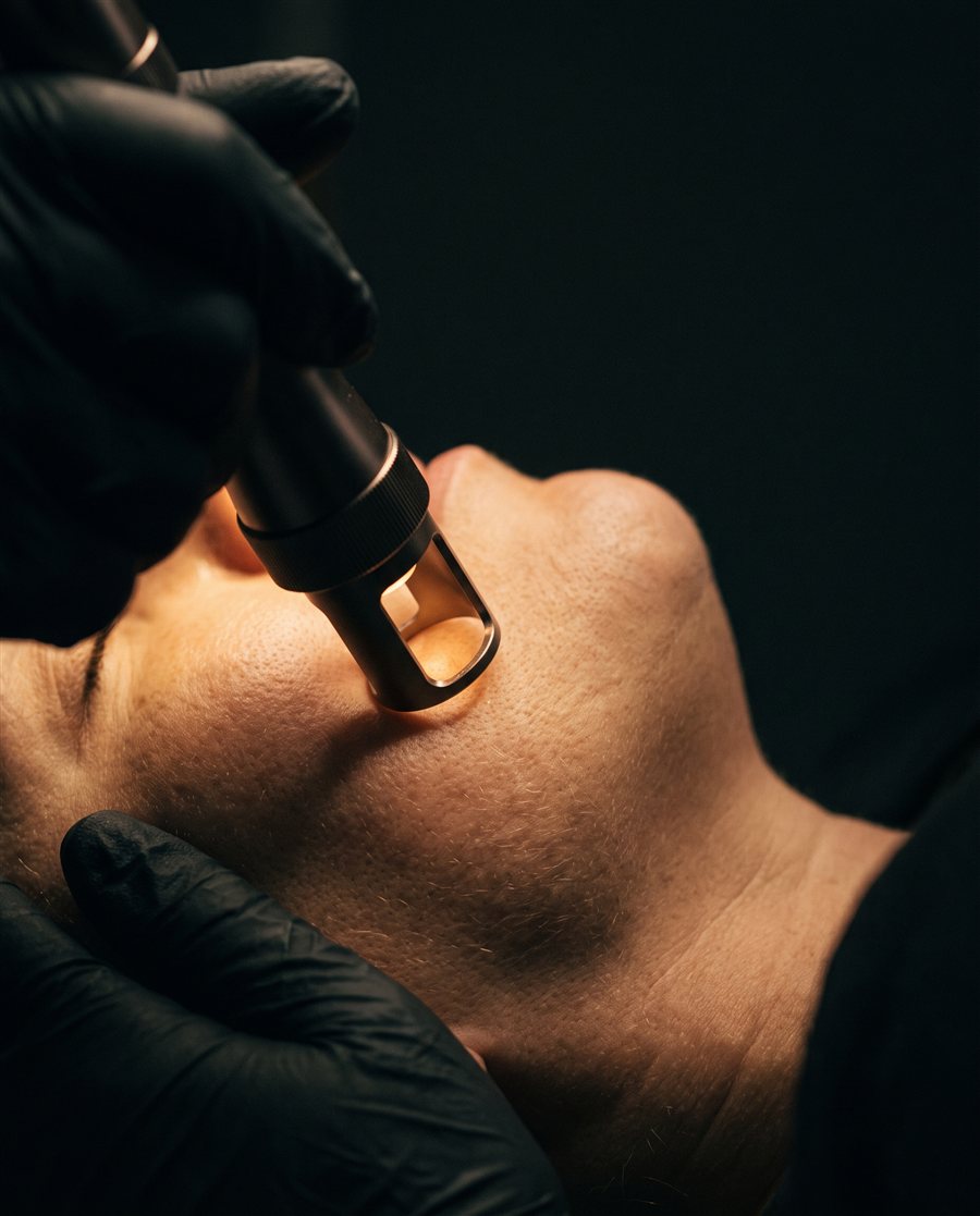 Resurfacing con láser CO2 en Orbe Clinics